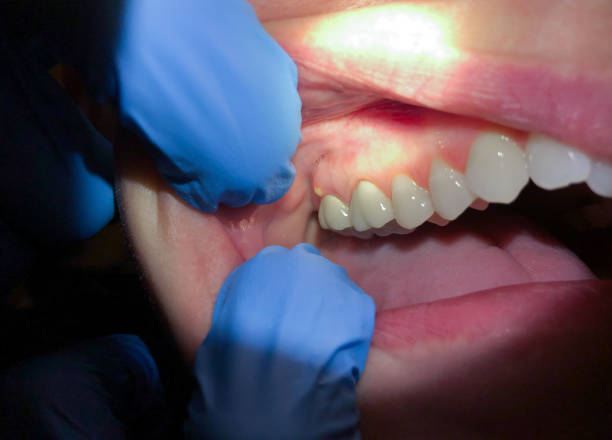 Best Emergency Treatment for Toothache in Kings Grant, NC