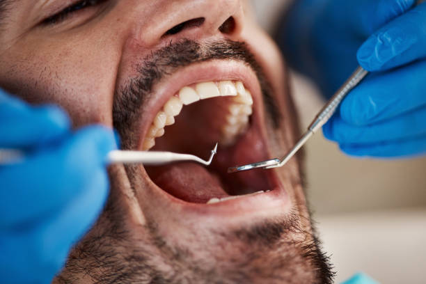 Fast & Reliable Emergency Dental Services in NC