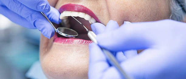 Best Emergency Tooth Extraction in Kings Grant, NC